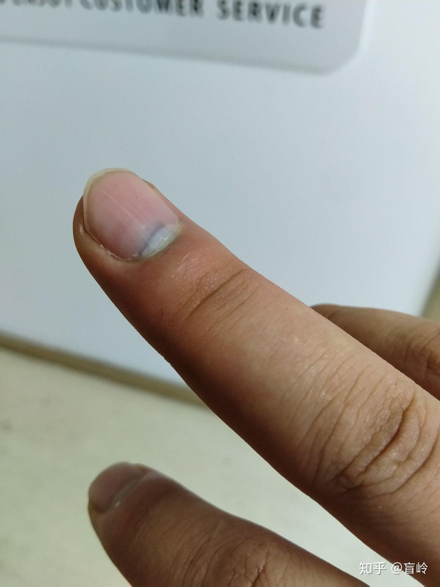 手指被门夹到飙泪是种怎样的体验? - 知乎
