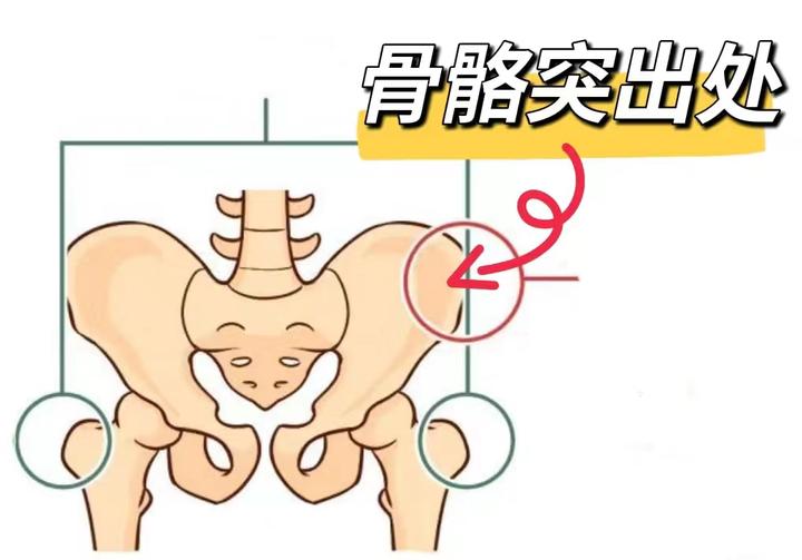 造口在骨骼突出处怎么护理？ - 知乎