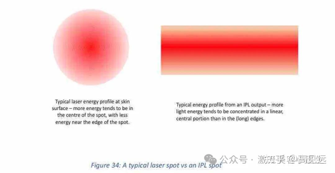 美容激光基础知识(八)(焦点前光斑的应用、IPL光导内能量分布) - 知乎
