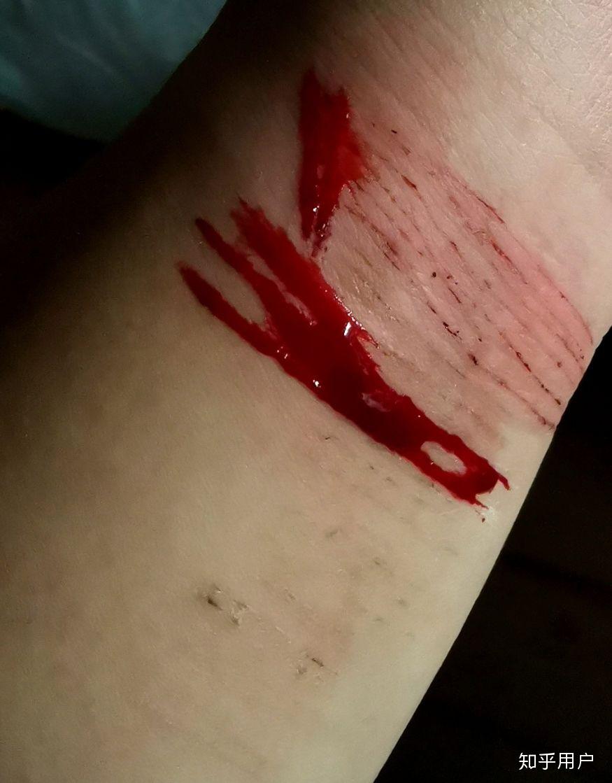 自残属于什么心理?