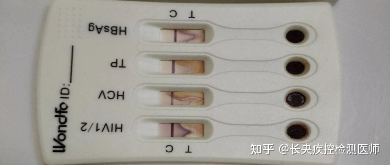 请问万孚四合一试纸测HIV准吗? - 知乎