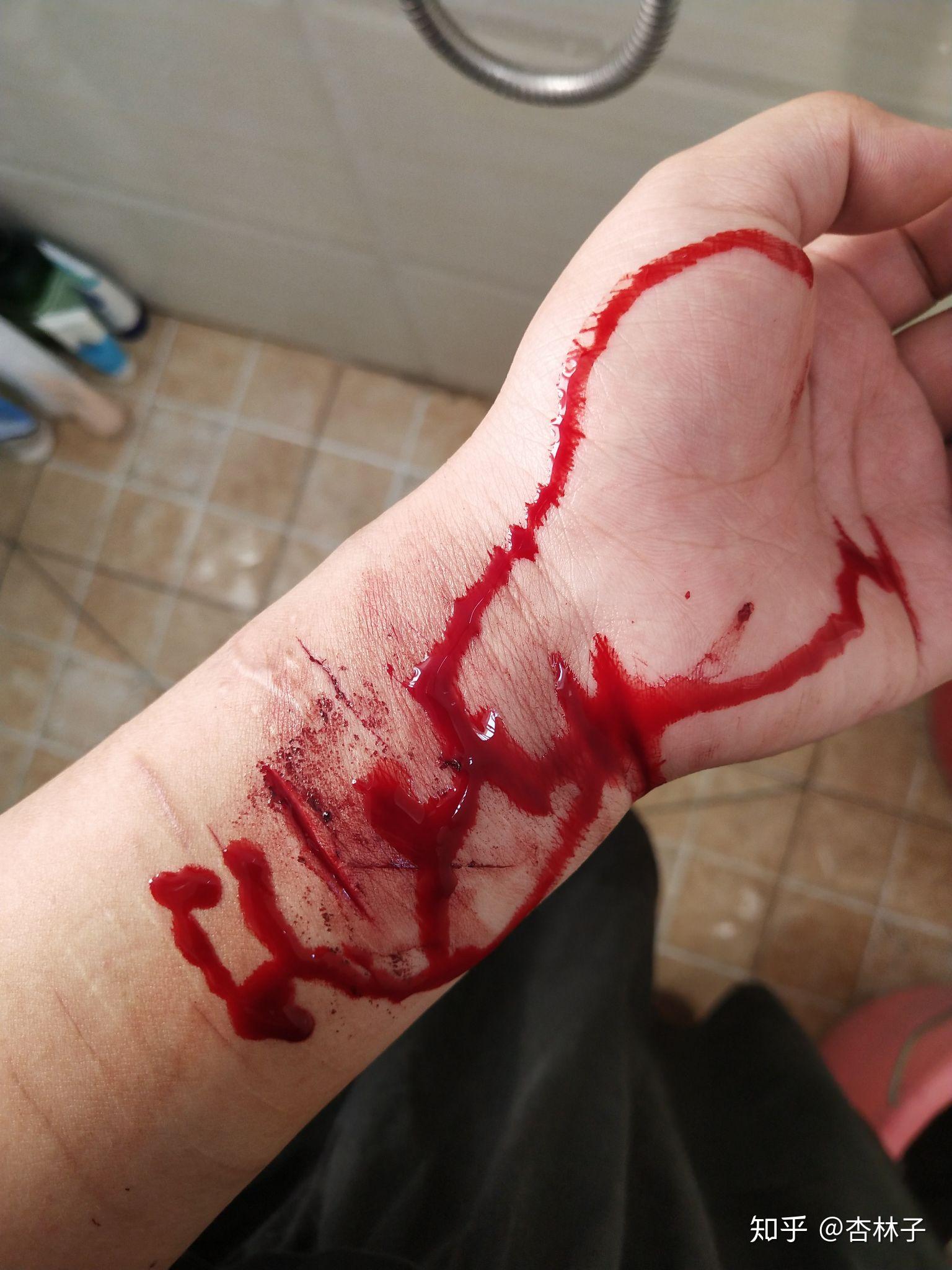 自残属于什么心理?