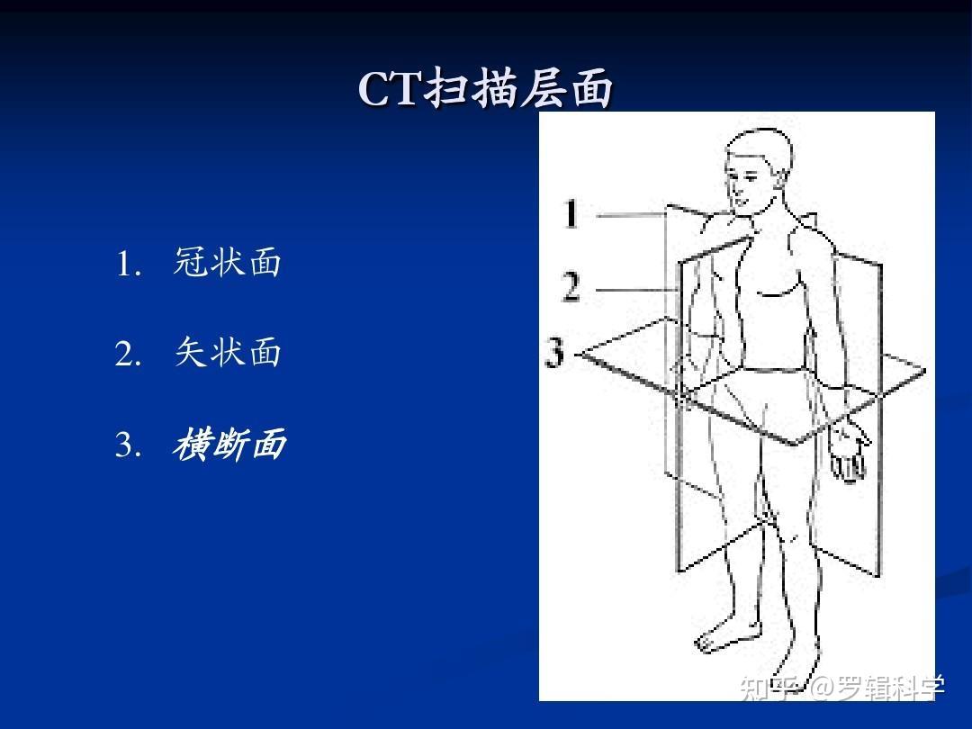 冠状位+矢状位+轴位图图片