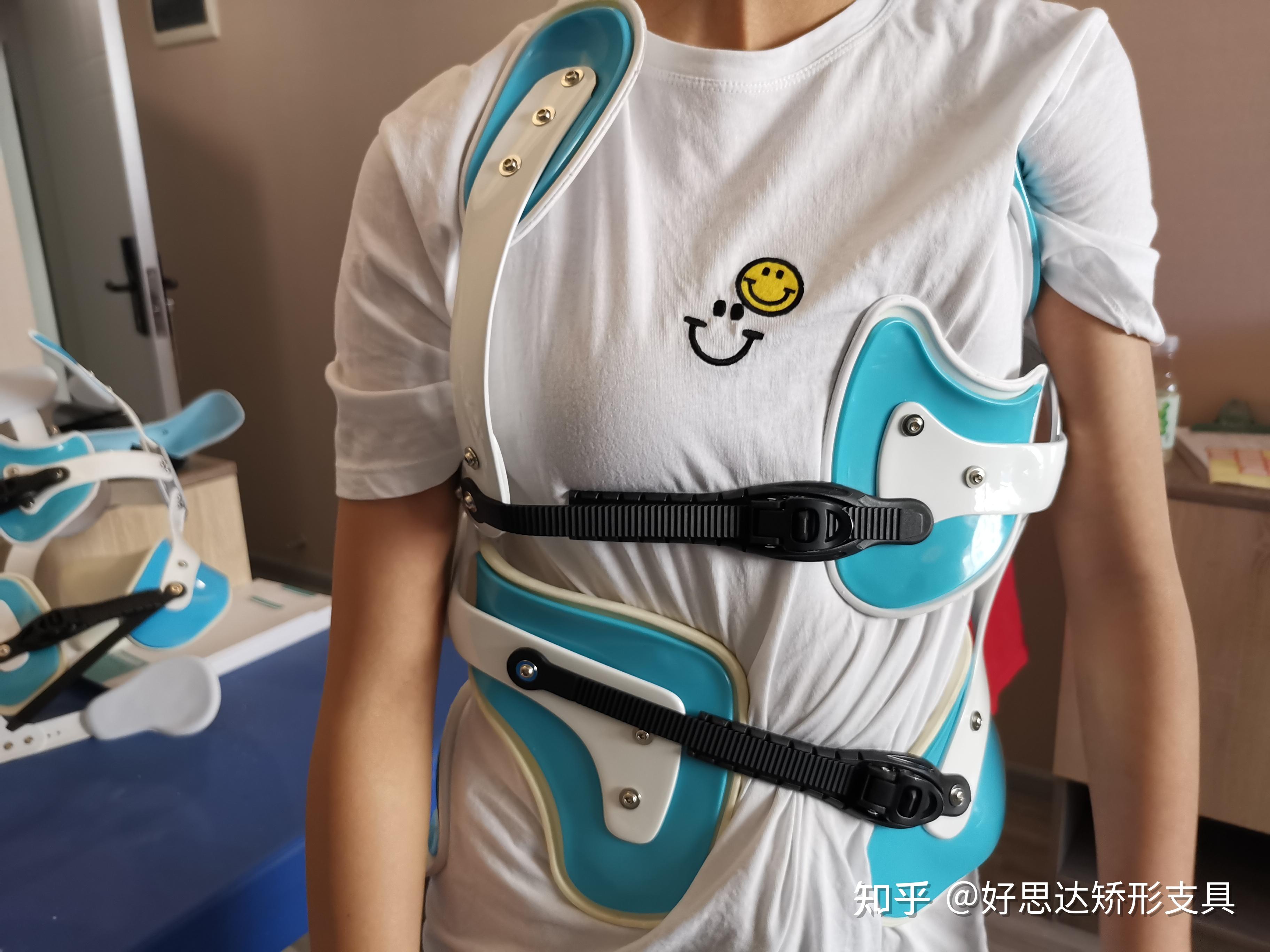 脊柱侧弯如何让自己克服戴支具的困难? - 知乎