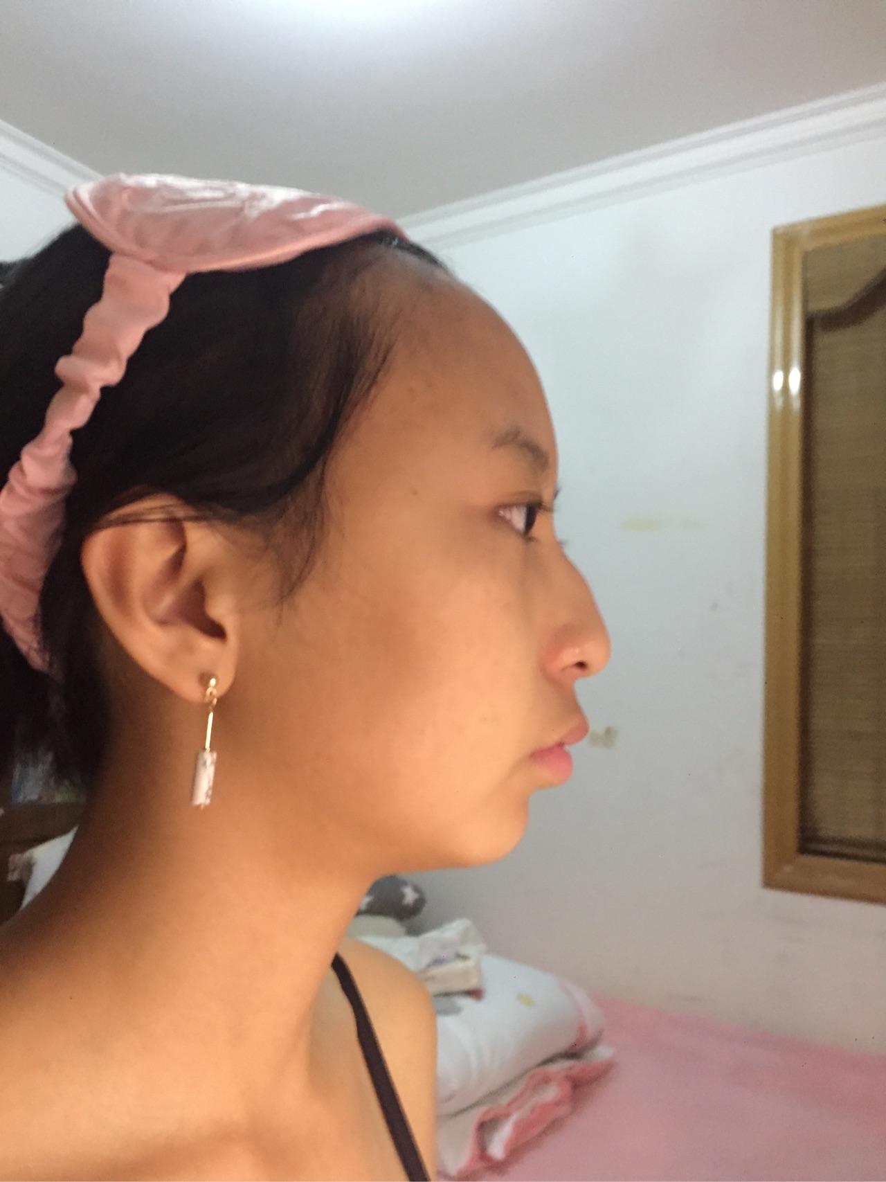 正脸好看侧脸丑哭是种什么样的体验