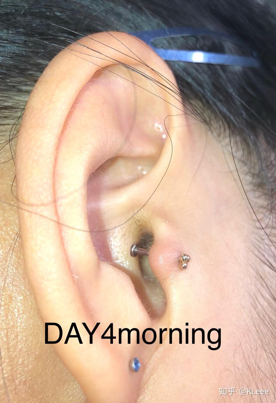 耳屏打耳洞有多痛? - 知乎