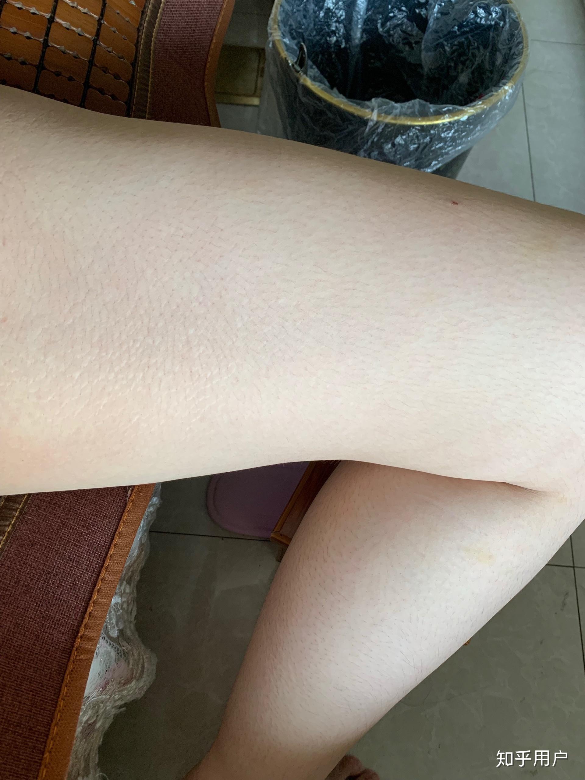 男生真的不喜欢腿粗的女生吗