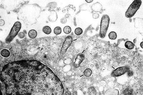 立克次氏体是革兰氏阴性菌还是阳性? - 知乎