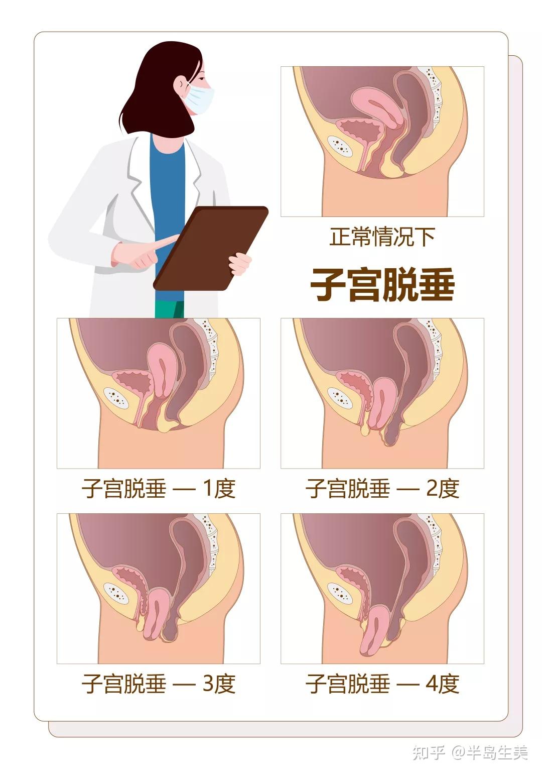 二次元 子宫  脱出 女人脱吧脱吧不是罪，是病！ - 知乎