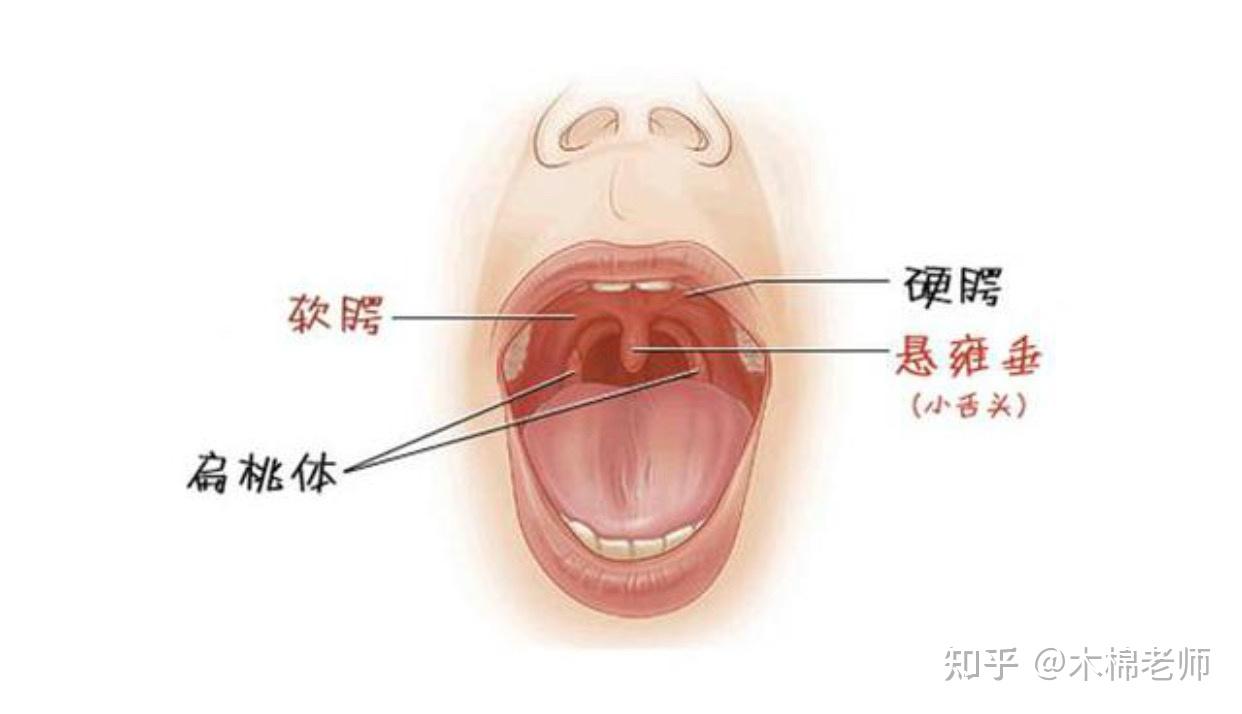 挺软腭训练图图片