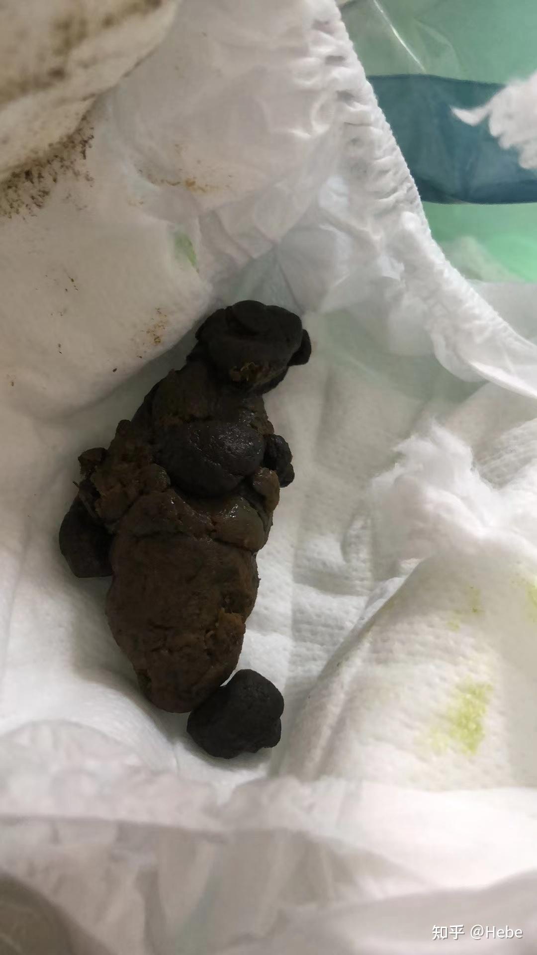 宝宝便秘应该如何护理