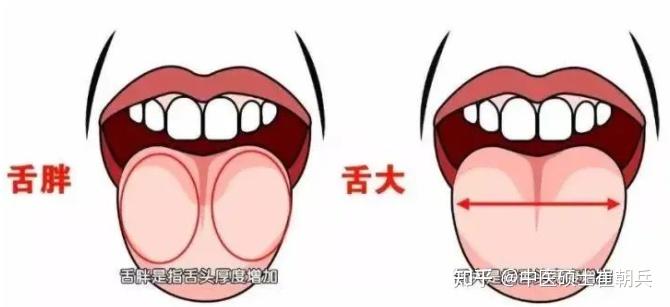 史上最全舌诊图谱！【珍藏版】 - 知乎