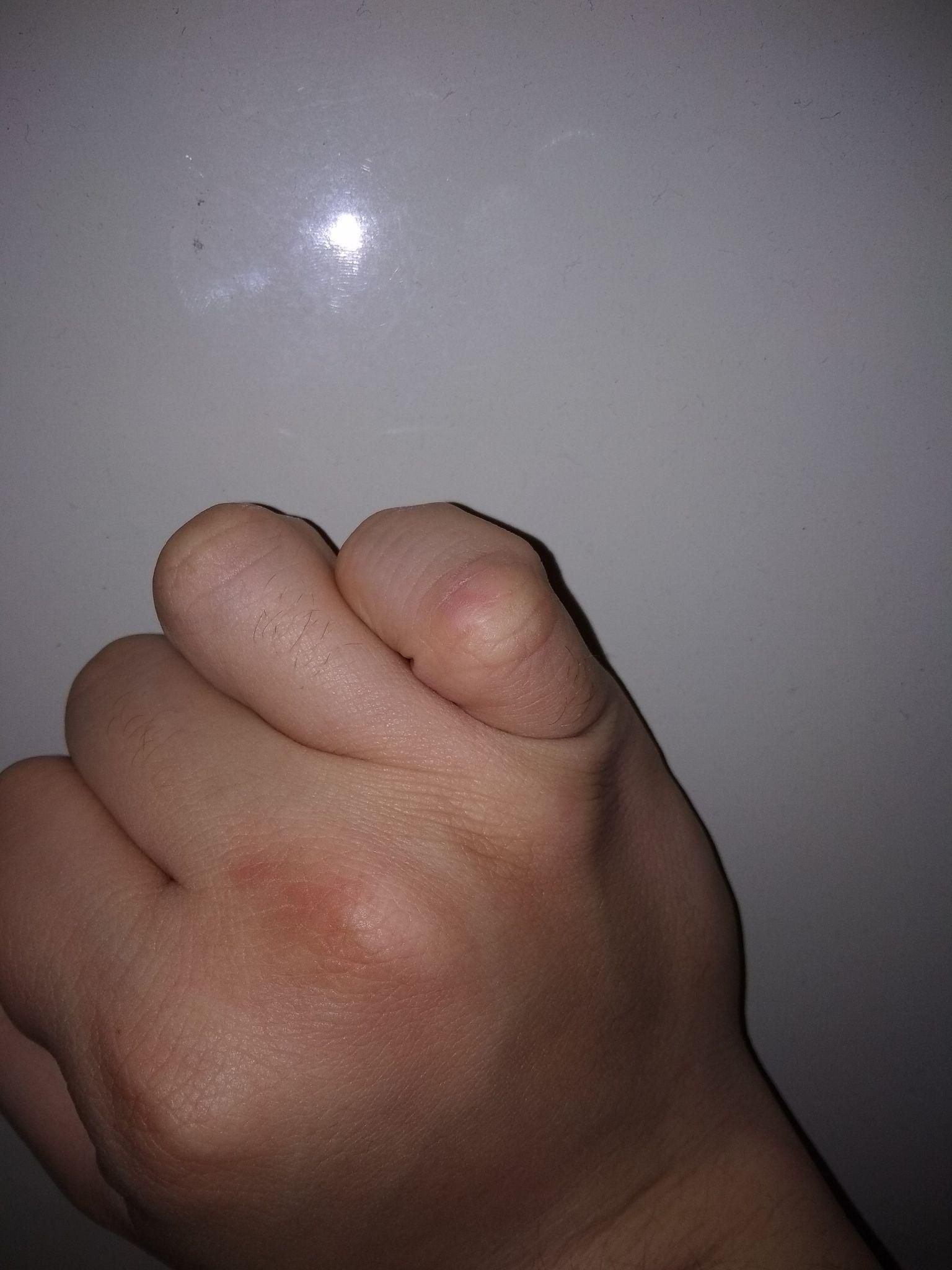 大家的拳茧都啥样了,想见见? - 知乎