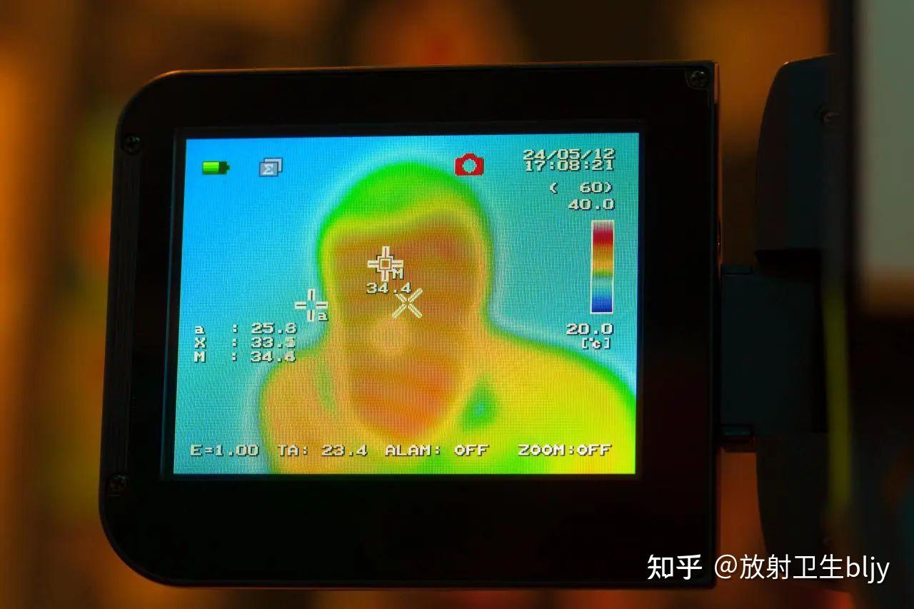 辐射危害！红外线引起的职业病 - 知乎