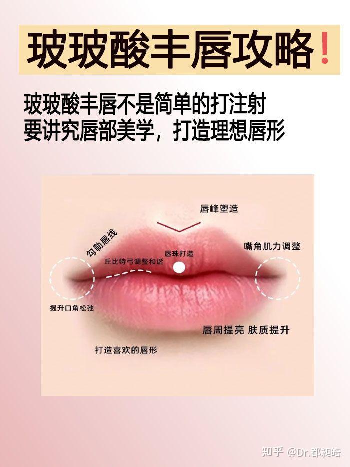玻🐤酸丰唇 唇型大集合,你想要的都在这!! - 知乎