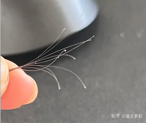为什么现在很多人都发际线后移，甚至秃的发光？ - 知乎