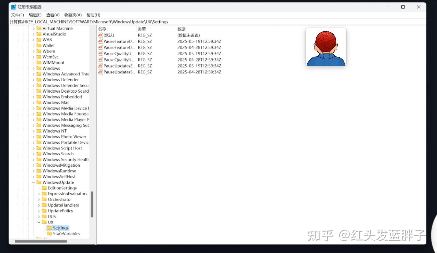Windows11 20 