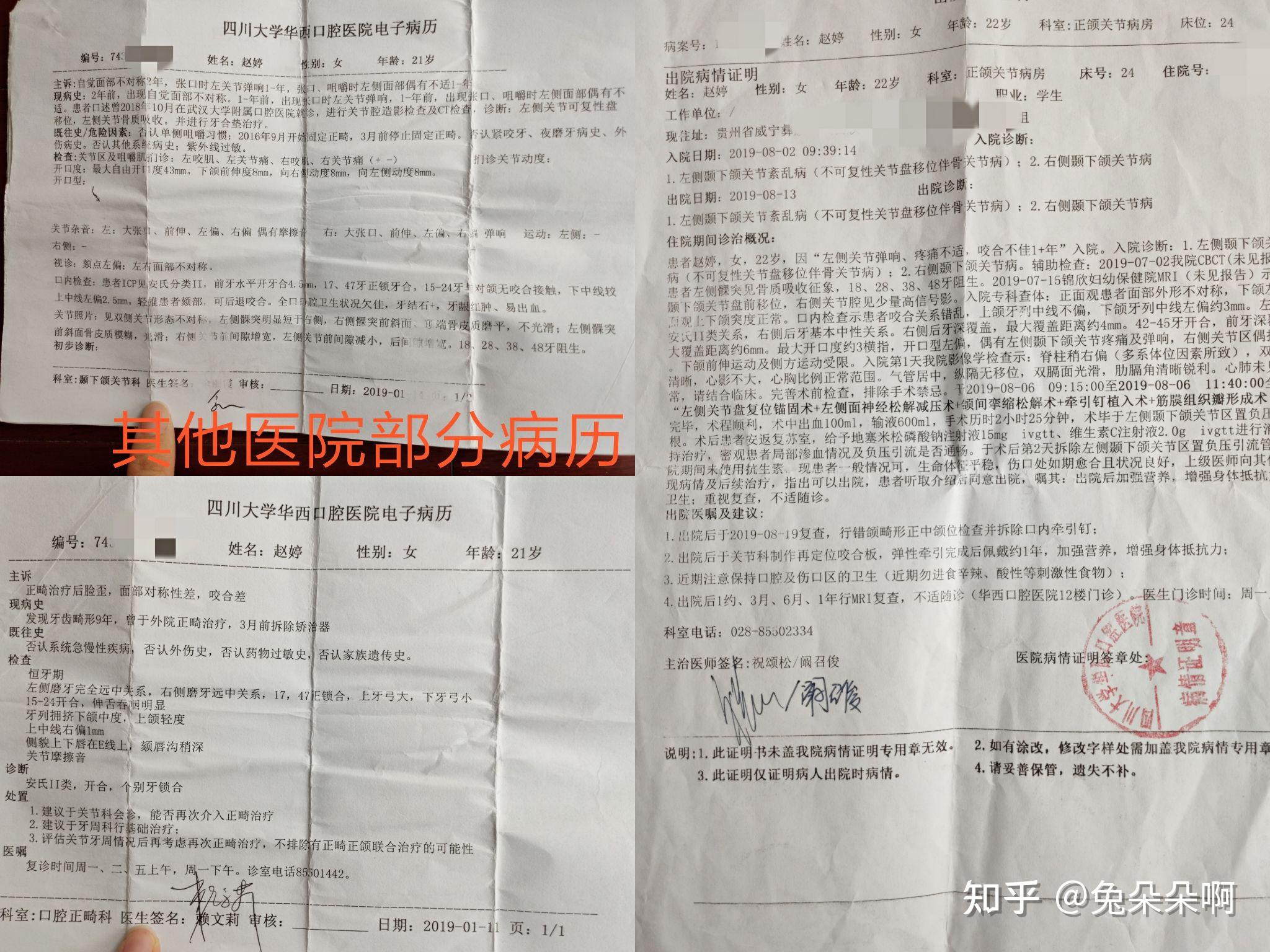 正畸过程中,你掉过多少次托槽?