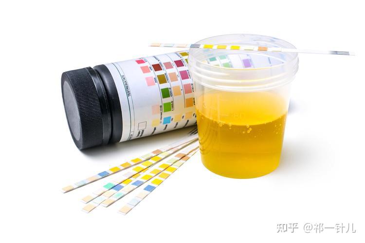 三甲医院血检尿检用的试纸还是显微镜? - 知乎