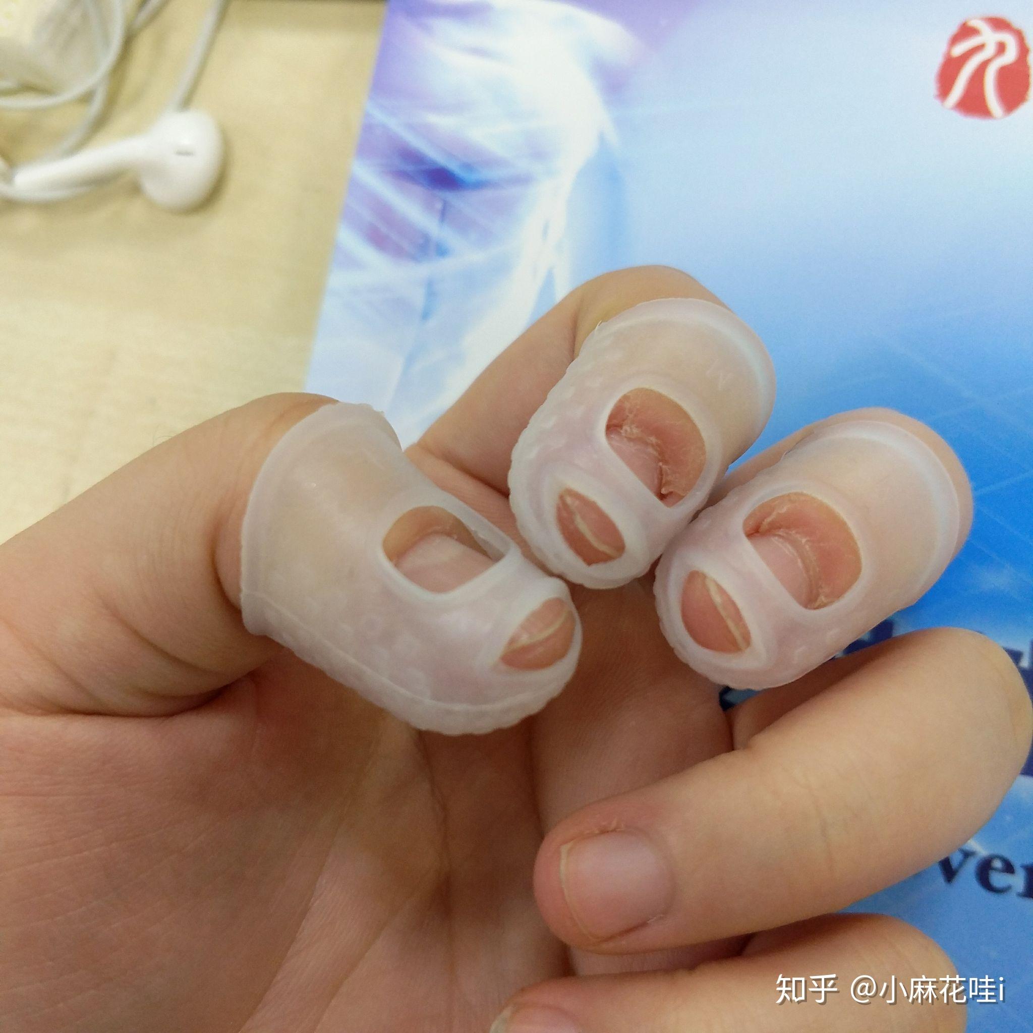 成年人如何改掉抠手的习惯有什么心理学道理