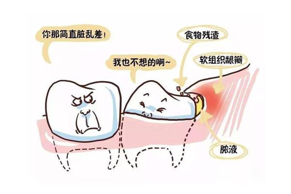 牙周病是什么?有什么危害呢? - 知乎