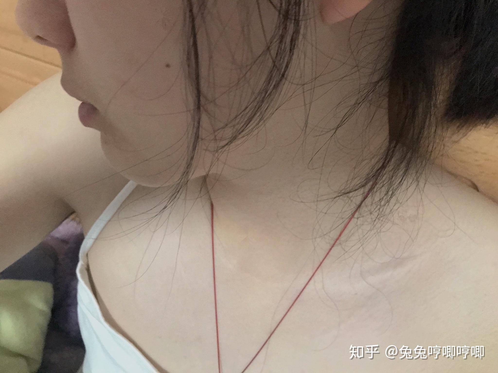 关注问题 67 写回答 登录/注册 胸部 平胸 身体发育 乳房 20岁胸部