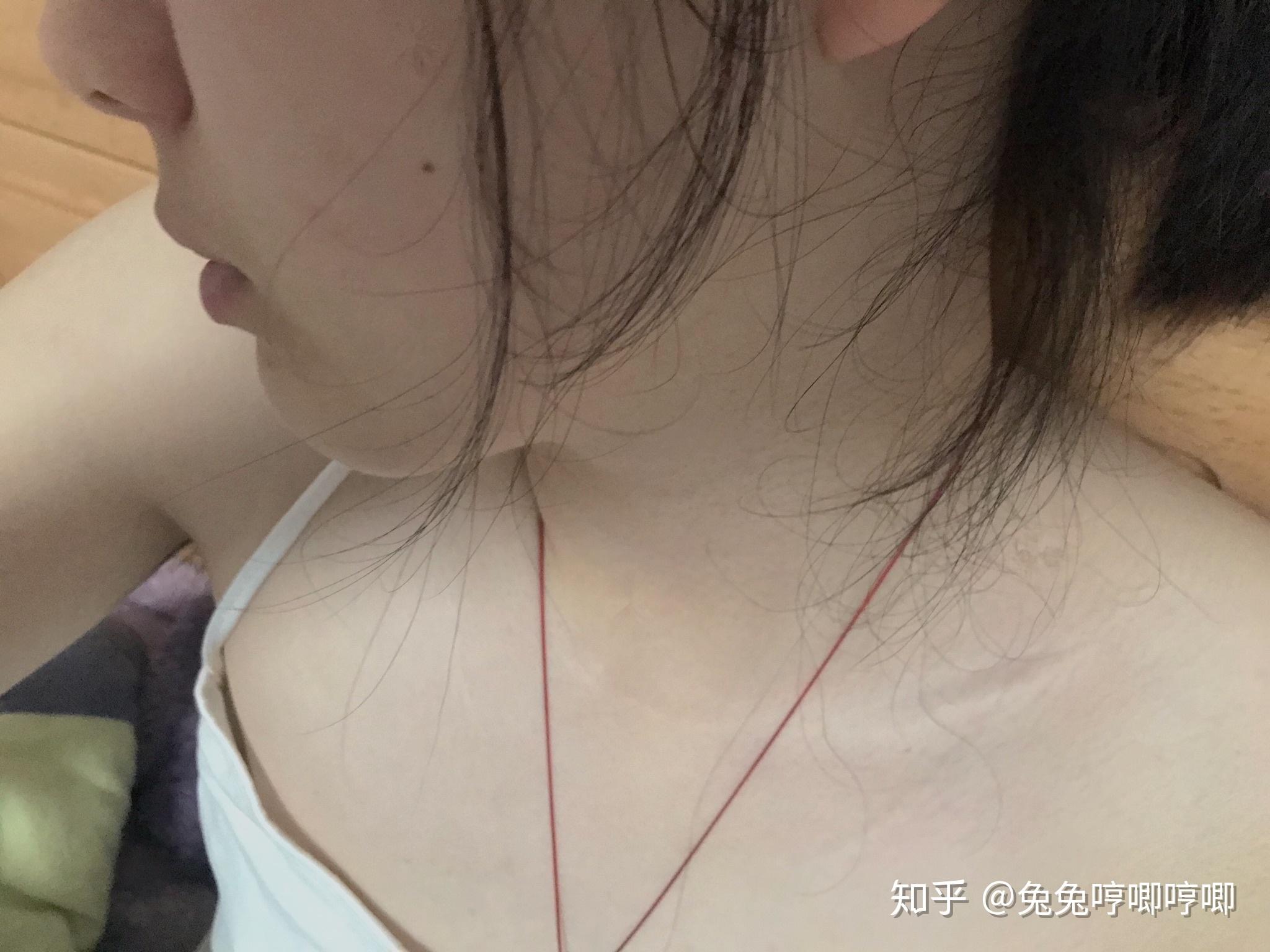 20岁胸部几乎没发育还有救吗