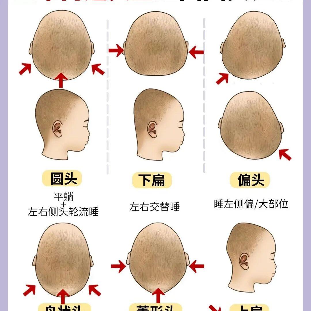 宝宝头型教你如何睡出小圆头常见正常问题头型特征