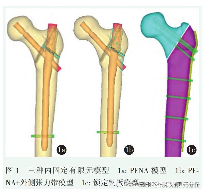 股骨粗隆间骨折内固定图片