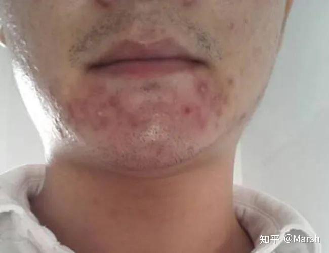 史上最全的刮胡子步骤教程,男性如何安全干净快速刮胡? - 知乎