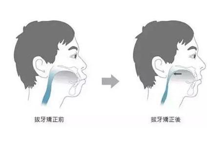 v2-aba81f0cf0bd50f36065e98e9d114555_1440w.jpg?source=172ae18b