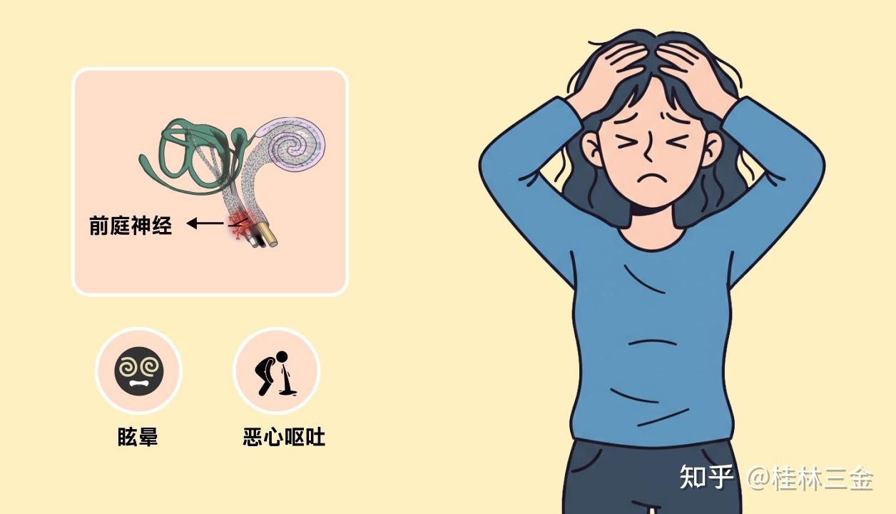 急性前庭综合症警告:感冒后出现这3个症状,当心前庭神经炎 - 知乎