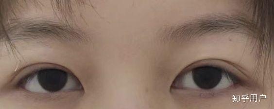 眼神无神和眼睛有神是怎么区别的