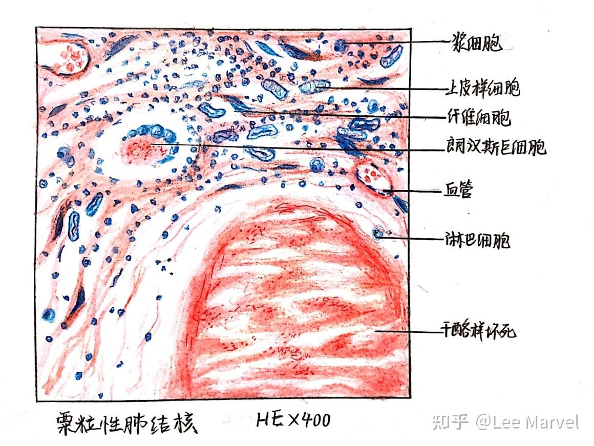 為什麼咱們不弄個病理紅藍手繪圖的問題呢