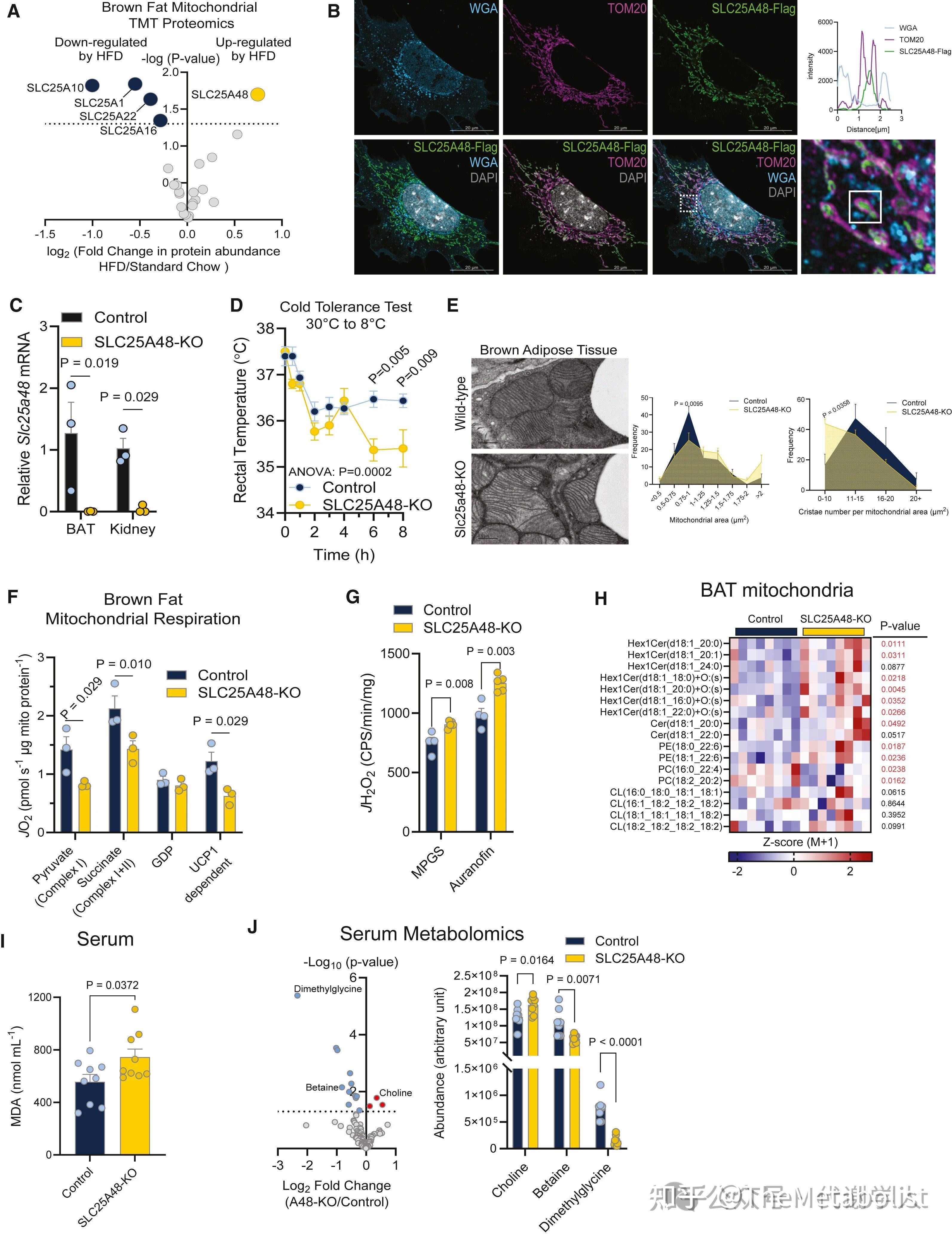 代谢学人——Cell Metabolism：胆碱转运供碳新，线粒体中贯通循 - 知乎