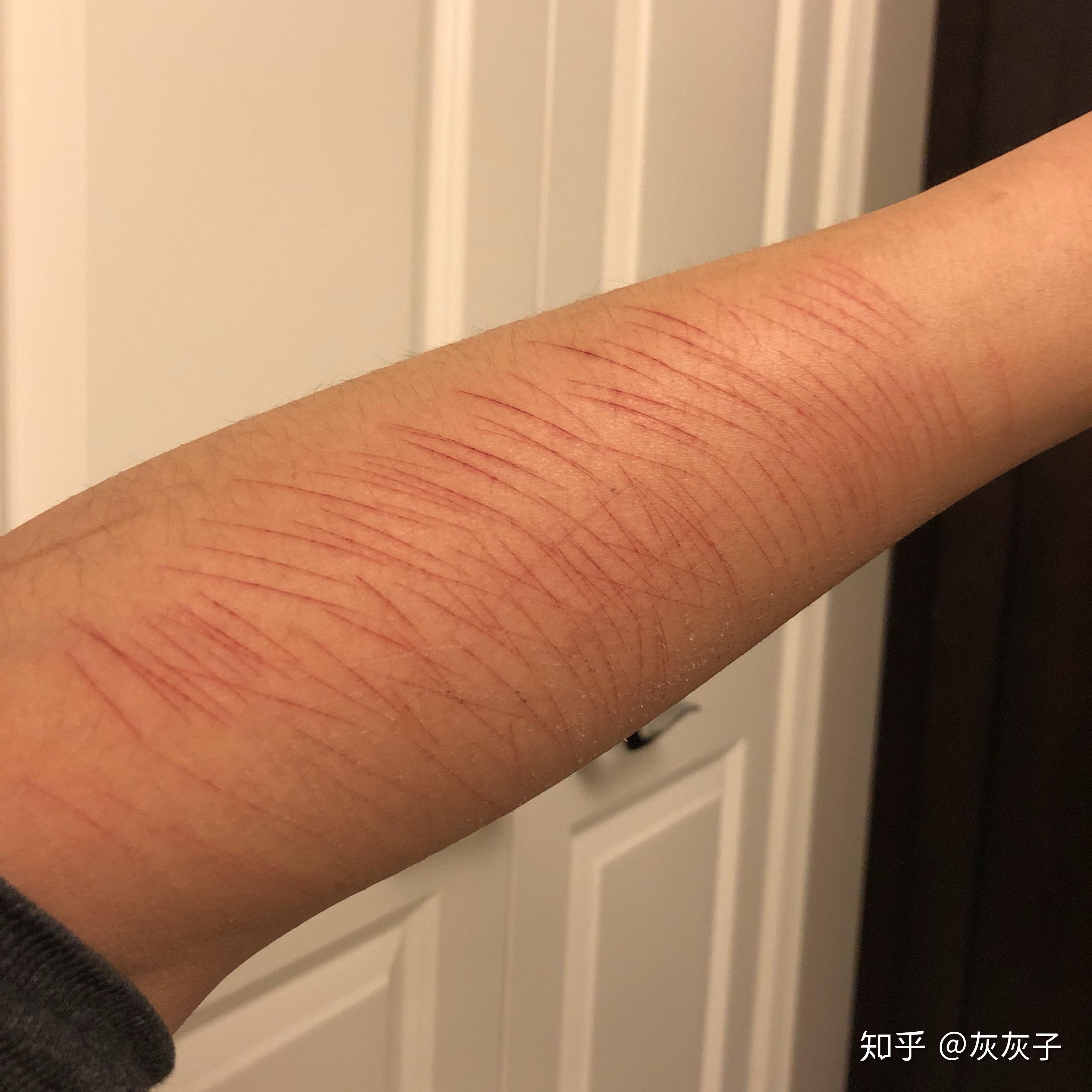 自残属于什么心理? - 知乎