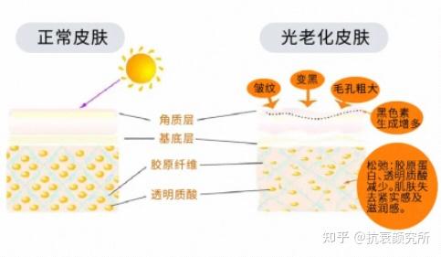 光老化是皮肤老化的头号杀手！如何对抗光损伤、光老化?（抗光老化攻略） - 知乎