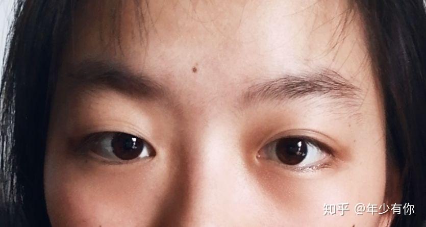 眼睛一单一双有什么办法解决吗? - 知乎
