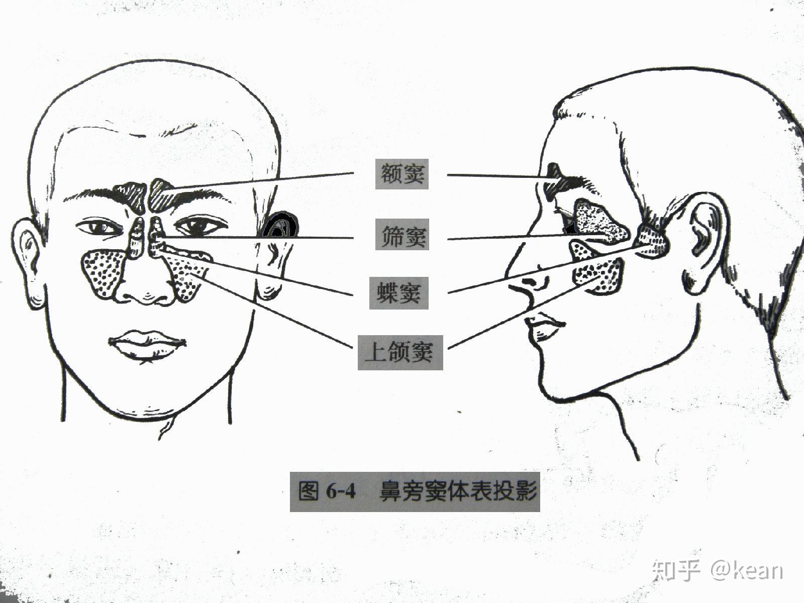 额窦共鸣图片