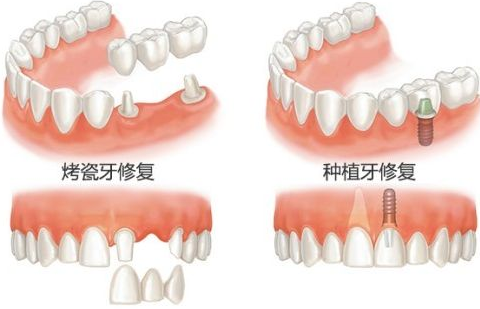v2-af0b78f8b460992cdd9ac183b5349d22_1440w.jpg?source=172ae18b