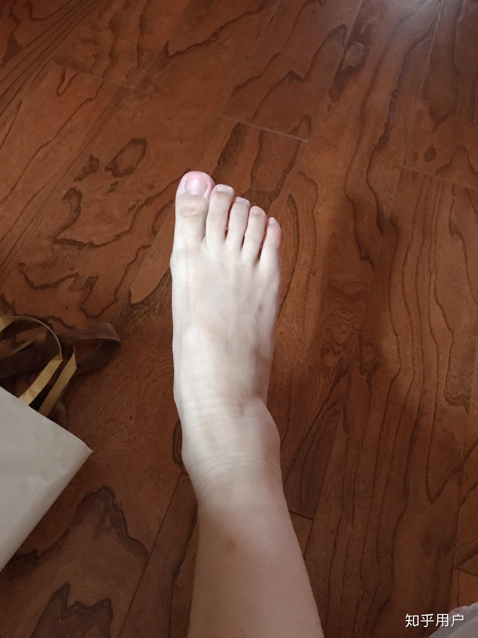 女生脚丑是种什么样的体验