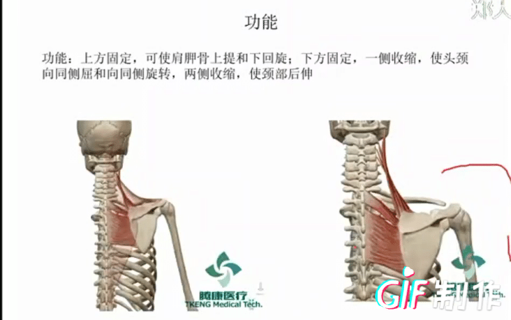 肩胛提肌（导致头痛头昏凶手） - 知乎