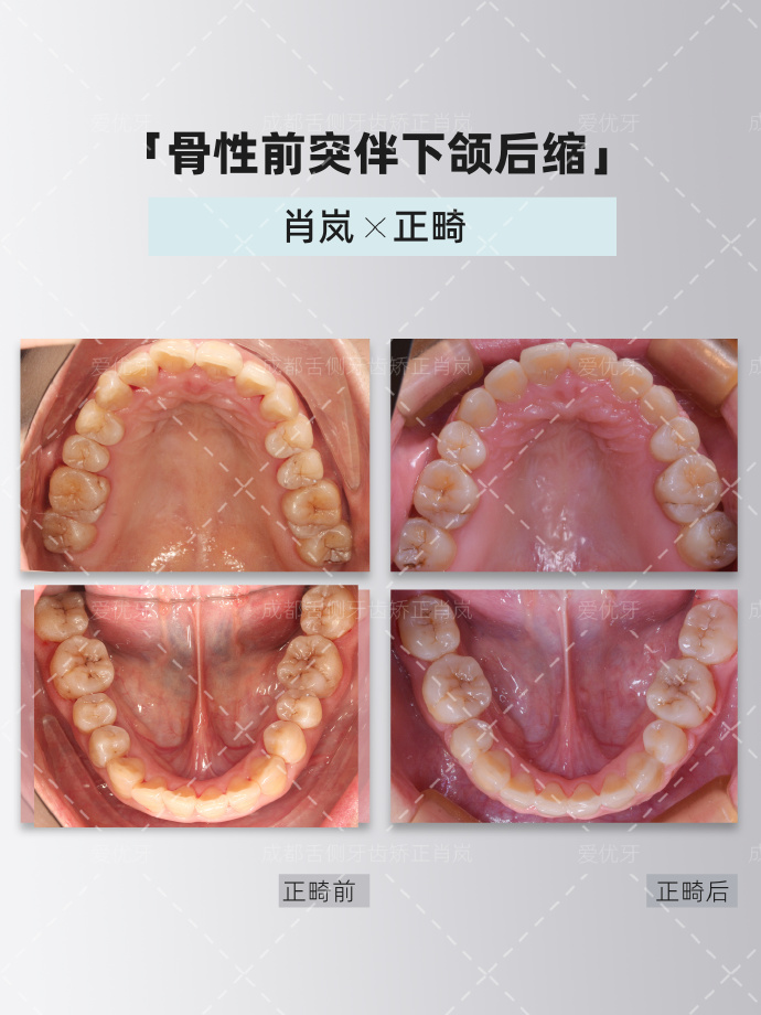 成都哪里正畸比较好?