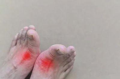 什么叫原发性高尿酸 v2-afae202006e48b990c9fc63006bbf398_1440w.jpg?source=172ae18b