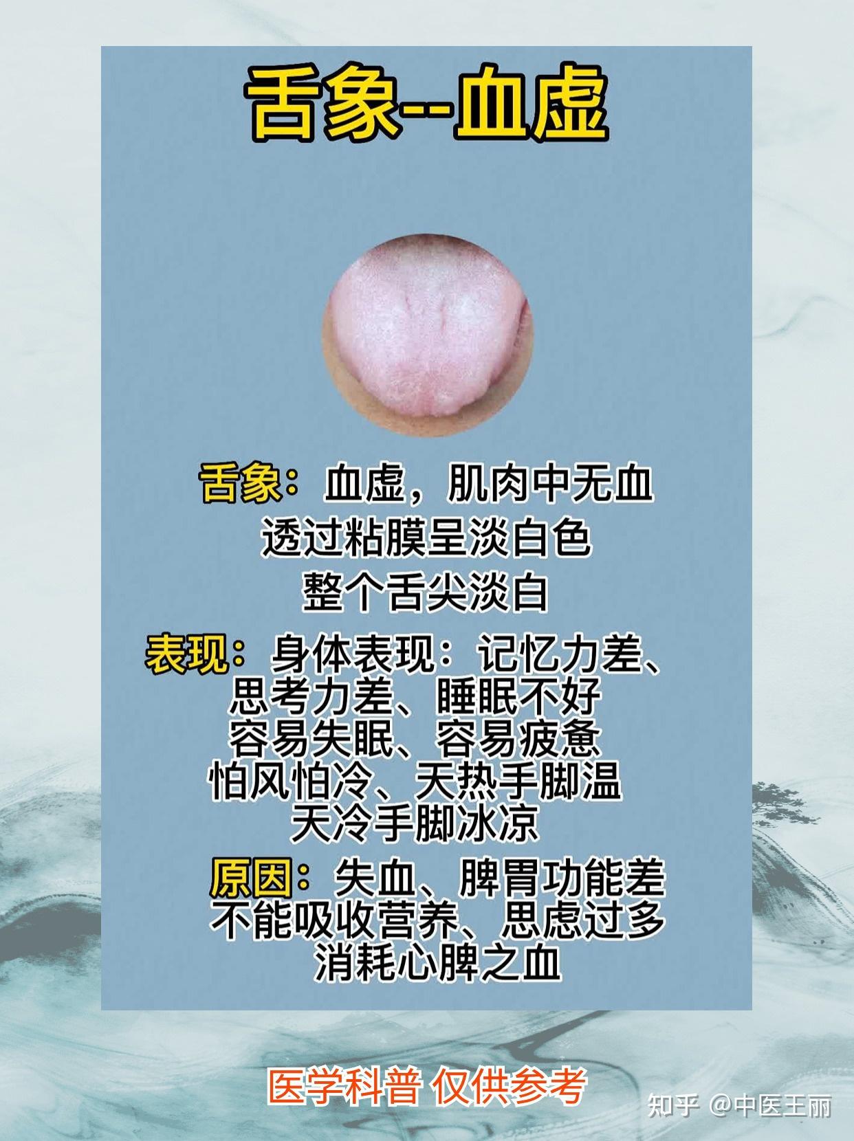看舌象,知健康,中医教你分辨六种舌象,对比一下你有没有 - 知乎
