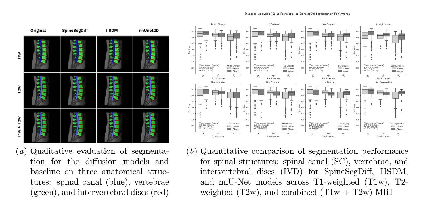 Diffusion Models