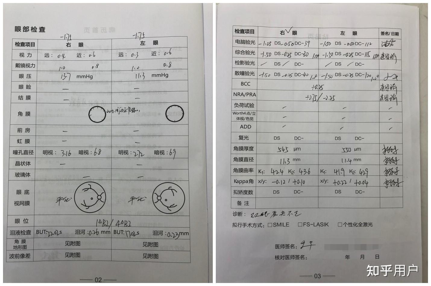 广州爱尔眼科和广州阿玛施眼科医院哪个做近视手术靠谱一个刚打广告