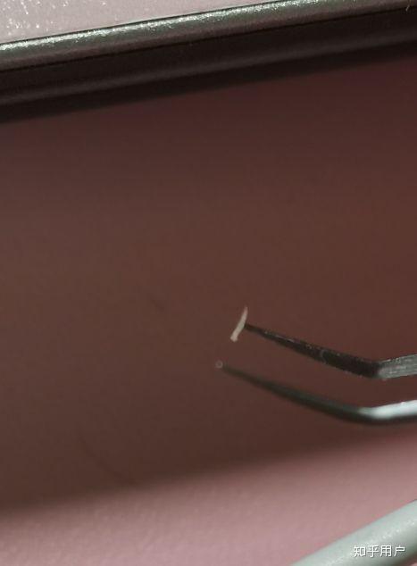 刺一开始像痘痘但是碰到了有点疼费力气拔出来一根刺像是角质怎么回事