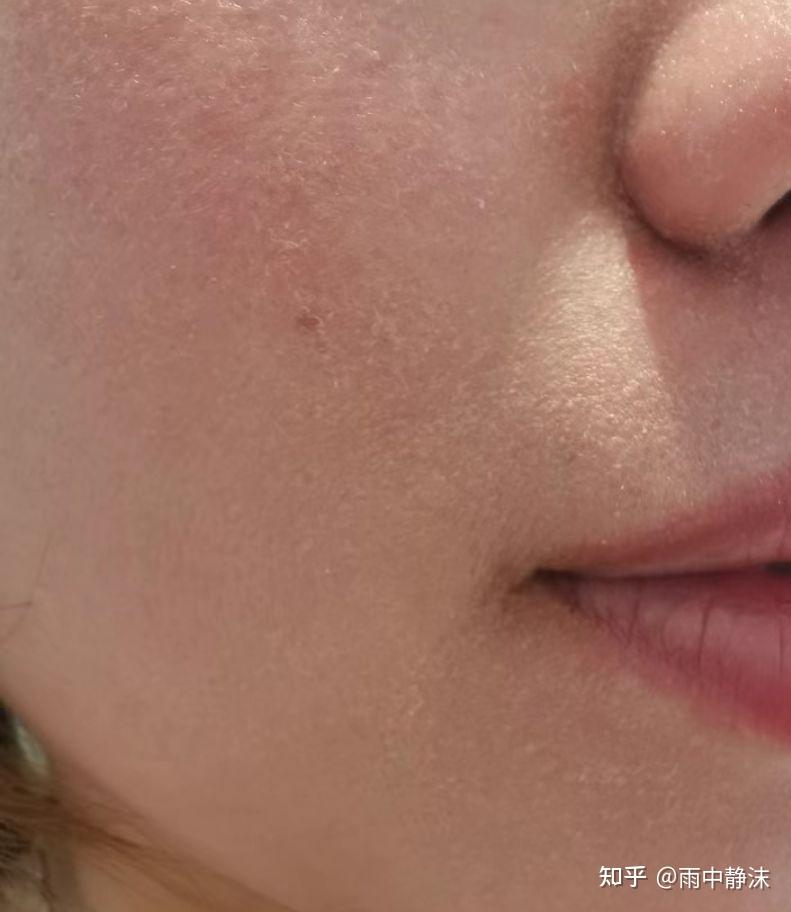 脸部起皮是什么原因?