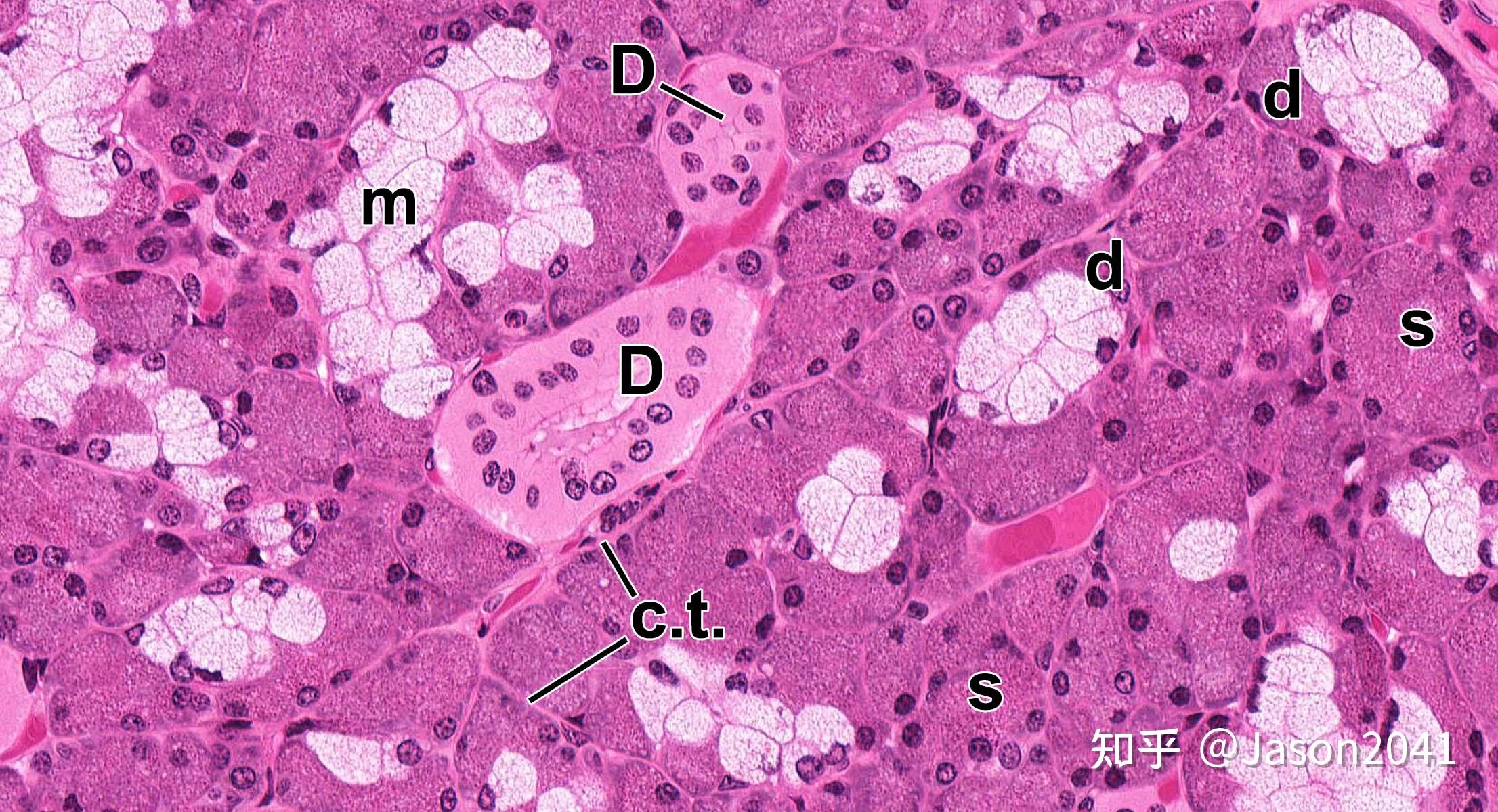 核医学唾液腺显像图片